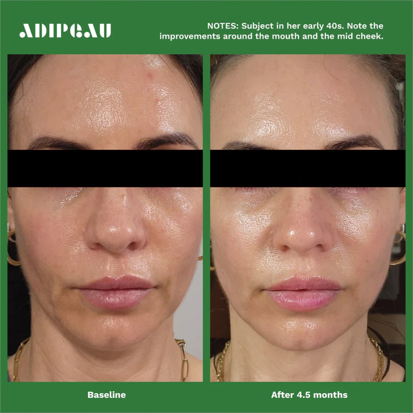 Adipeau Volume Cream (60ml)