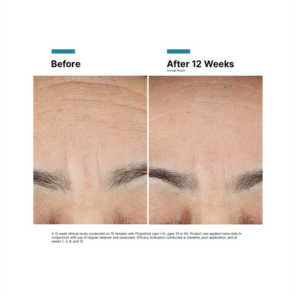SkinCeuticals Advanced RGN-6