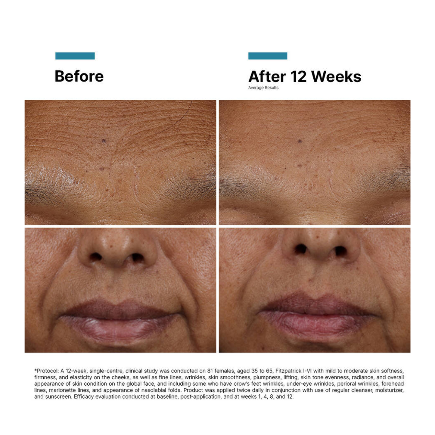 SkinCeuticals H.A. Intensifier Multi-Glycan