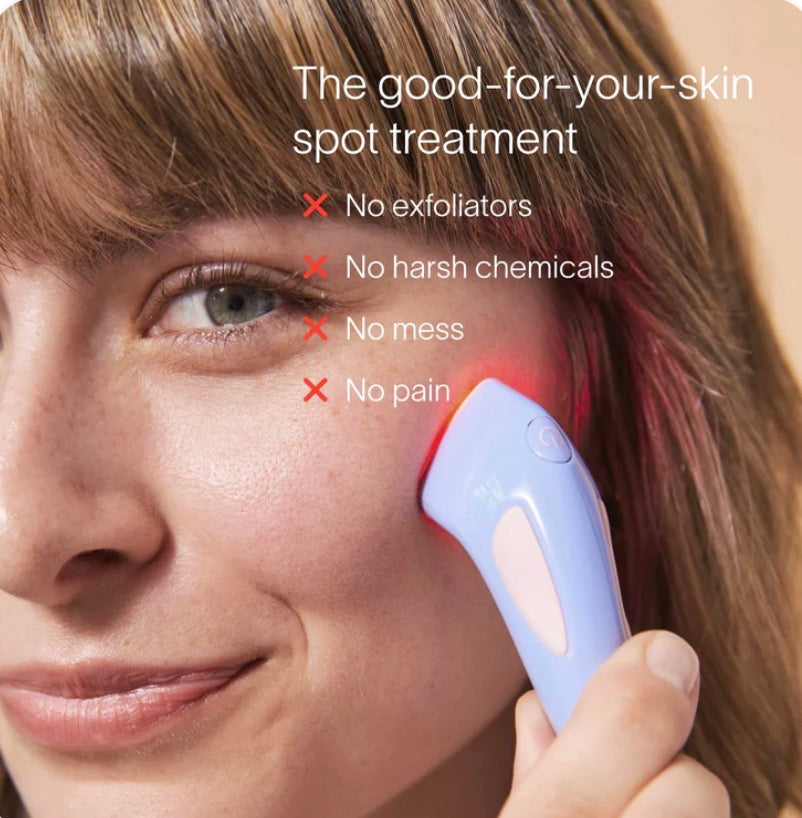 Solawave Bye Acne Spot Treatment - Red & Blue Light Therapy for Fast Acne Clearing