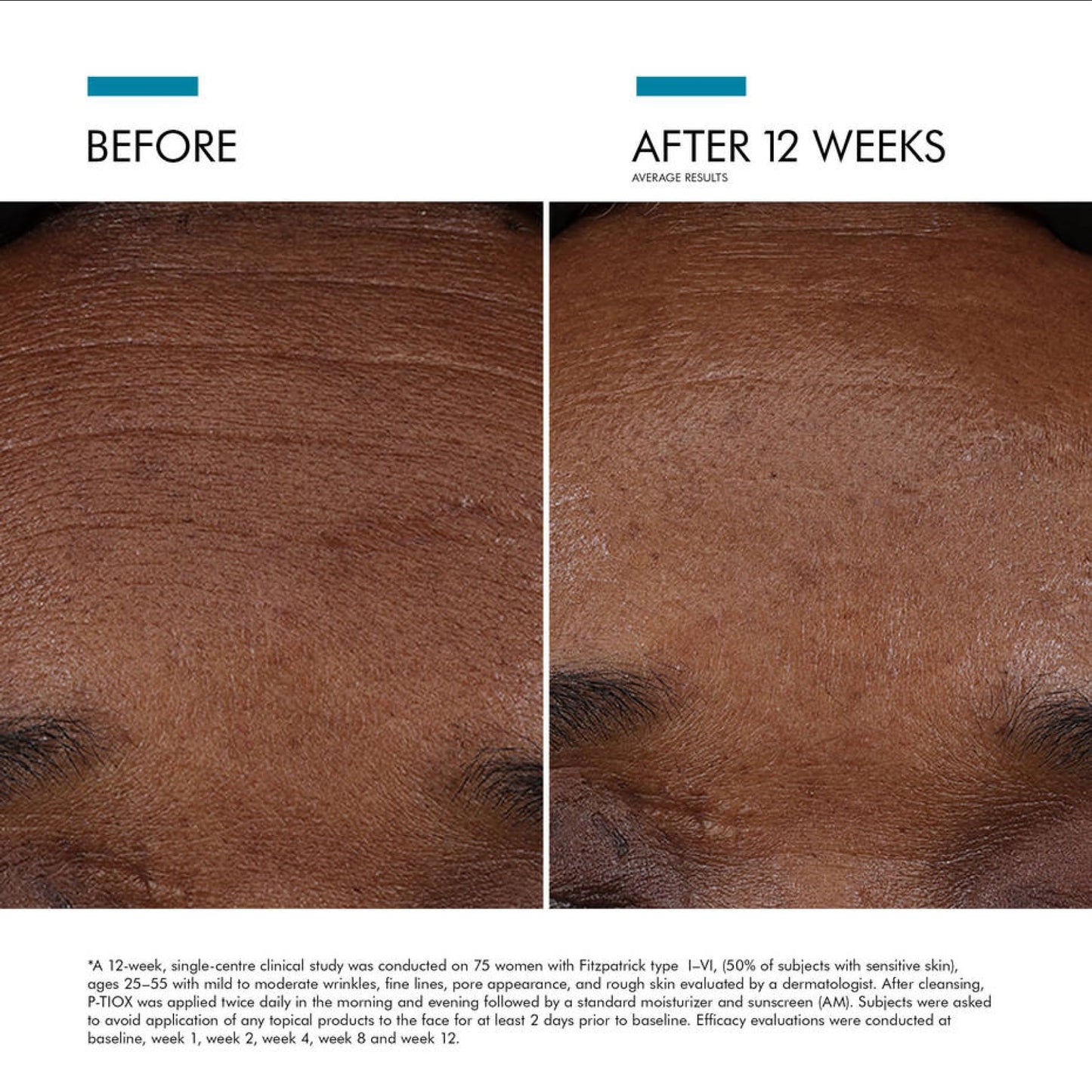 SkinCeuticals P-TIOX — Needle-Free Anti-Wrinkle Serum