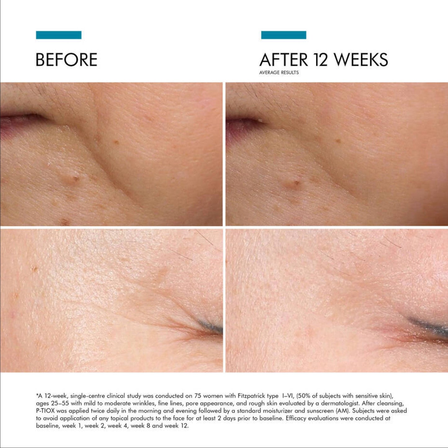 SkinCeuticals P-TIOX — Needle-Free Anti-Wrinkle Serum