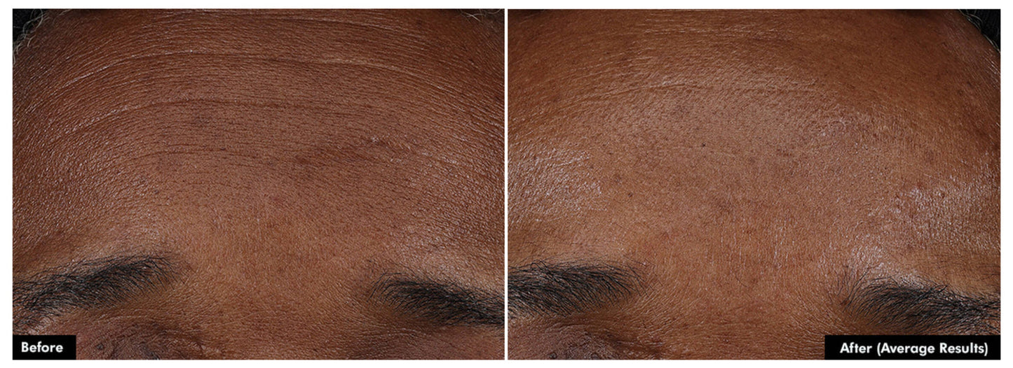 SkinCeuticals P-TIOX — Needle-Free Anti-Wrinkle Serum