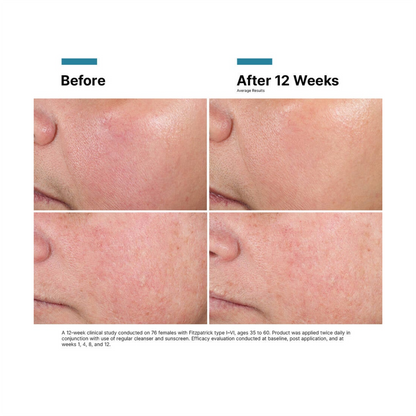 SkinCeuticals Advanced RGN-6