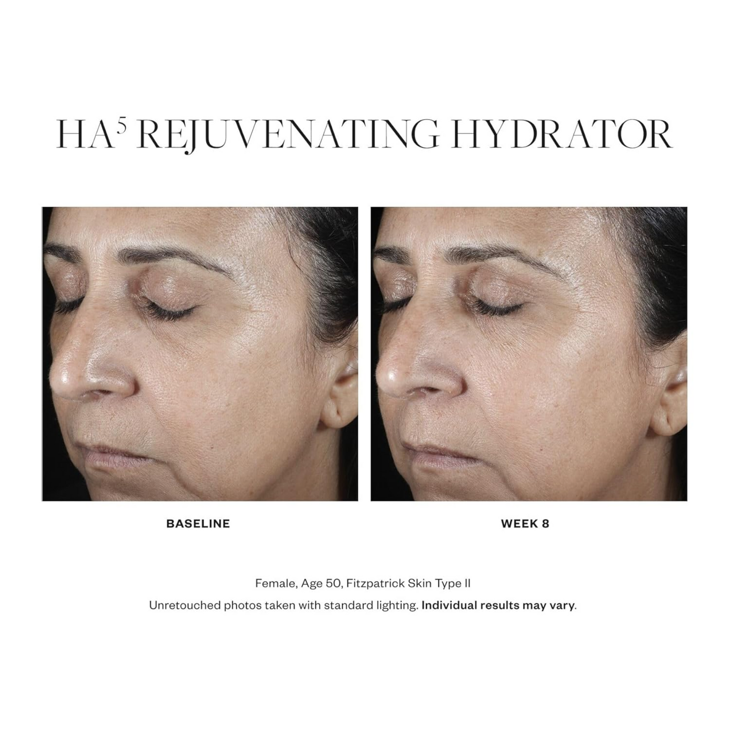 SkinMedica HA5® Rejuvenating Hydrator