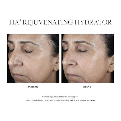 SkinMedica HA5® Rejuvenating Hydrator