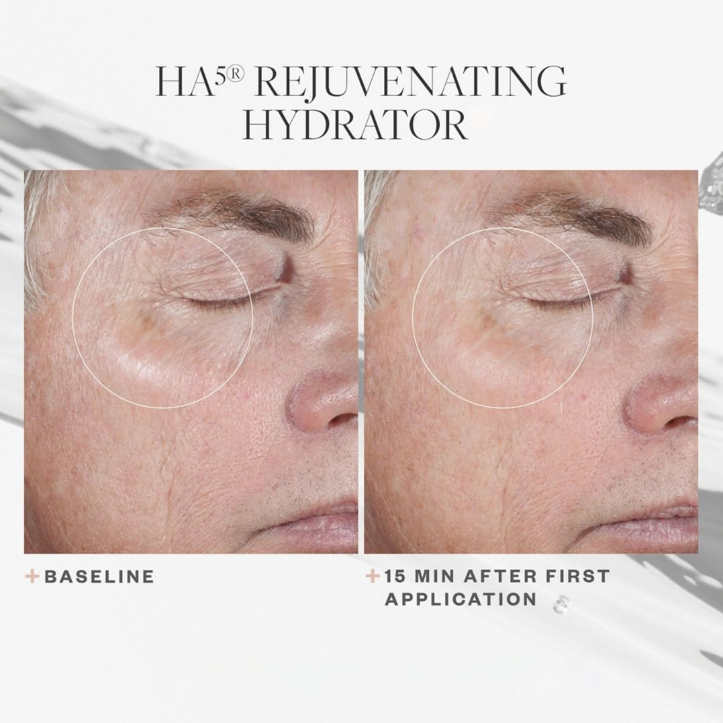 SkinMedica HA5® Rejuvenating Hydrator