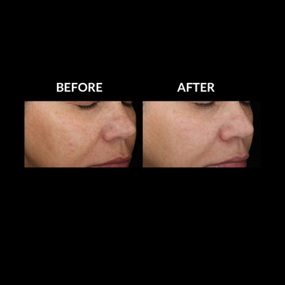 SkinMedica Lytera™ 2.0 Pigment Brightening Serum