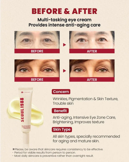 KSECRET SEOUL 1988 Eye Cream: Retinal Liposome 4% + Fermented Bean 30ml